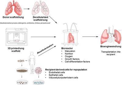 Advances in lung bioengineering: Where we are, where we need to go, and how to get there